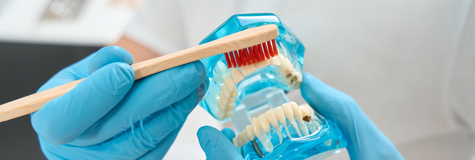 What You Need to Know About Oral Cancer Screening